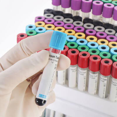 Mua Vacuum EDTA Blood Tubes for Complete Blood Count (CBC) – High Quality, Secure Seal sản xuất trực tuyến