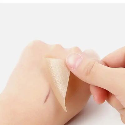 Giá tốt Bàn da sẹo silicone, băng, dải - Chữa lành Keloid, C-Section, Belly Tuck - Điều trị vết sẹo phẫu thuật trực tuyến